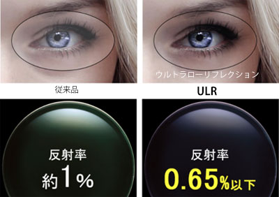 ULR